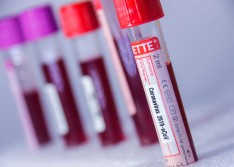 Casos de Covid-19 crescem mais de 550% no Piauí em duas semanas; óbitos 300%