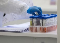 Covid: Brasil tem 189 mortes confirmadas em 24 h; total chega a 4.205