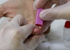 Três casos de Covid-19 são confirmados em Água Branca; dois pacientes são idosos