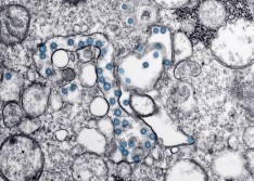 Brasil registra 421 mortes nas últimas 24 horas