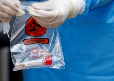 Duas pessoas testam positivo para Coronavírus em Vila Nova do Piauí