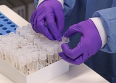 Governo do Estado cria comitê médico para estudar o uso de alguns medicamentos contra Covid-19