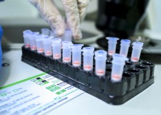 Piauí registra mais duas mortes e chega a 3 mil casos do novo coronavírus