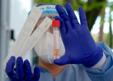 Teresina registra mais duas mortes por Covid, Piauí chega a 665 casos em 60 municípios