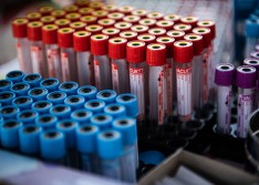 Piauí tem 215 novos casos do coronavírus em 24 horas; total de mortos chega a 91