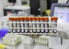 Piauí registra 72 mortes e 2252 casos confirmados de coronavírus