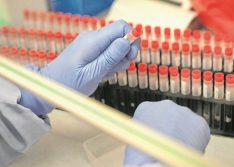 Coronavírus: Picos registra mais 12 casos em 24 horas