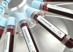 Piauí registra mais 15 mortes e ultrapassa 15 mil casos confirmados de Covid-19