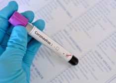 Covid-19: Picos registra mais 12 casos nas últimas 24h