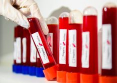 Piauí chega a 180 mortes e volta a bater recorde com 387 casos de Covid em 24 horas