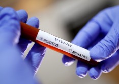 Piauí registra 960 mortes e 33.359 casos de covid-19, diz Sesapi