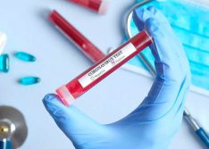 Covid: Picos registra 69 novos casos em 24 horas