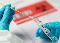 Covid: Picos registra 38 novos casos em 24 horas