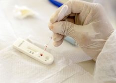 Justiça derruba decisão que obrigava planos de saúde a cobrir exame para Covid-19