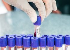 Covid: Picos registra 40 novos casos em 24h