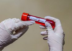 Piauí registra 16 mortes e mais 540 novos casos do coronavírus em 24 horas