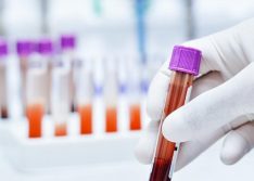 Exame de sangue permite diagnosticar esquizofrenia e bipolaridade