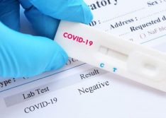 Covid-19: Picos registra mais um óbito
