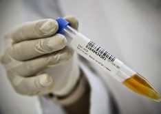 Piauí registra 673 casos e 13 mortes pelo coronavírus nas últimas 24 horas