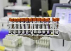 Piauí ultrapassa os 100 mil casos de Covid e 8 óbitos são registrados