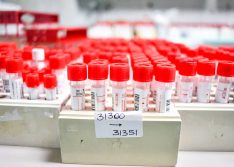 Covid-19: Piauí tem nove óbitos e 582 novos casos em 24h