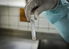 Piauí registra 34 casos confirmados e um óbito por Covid-19 nas últimas 24 horas