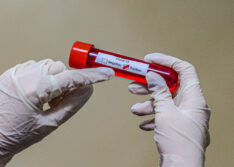 Em quatro dias, Picos registra 253 casos de Covid-19