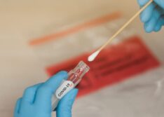 Casos de Covid-19 aumentam em 37% no Piauí