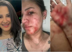 Influenciadora é atacada com golpes de tesoura na frente da filha em Pio IX