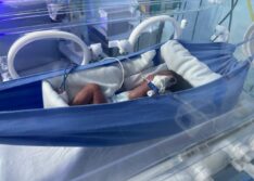 Nova Maternidade usa redinhas para promover conforto e desenvolvimento de bebês prematuros